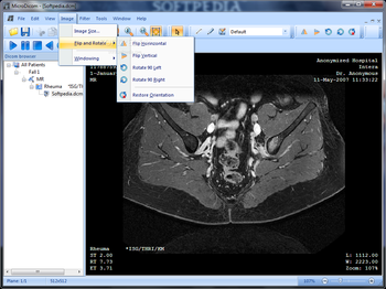 MicroDicom screenshot 3