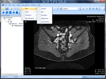 MicroDicom screenshot 4