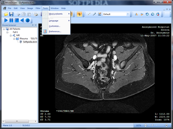 MicroDicom screenshot 5