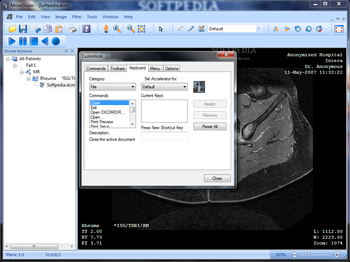 MicroDicom screenshot 8
