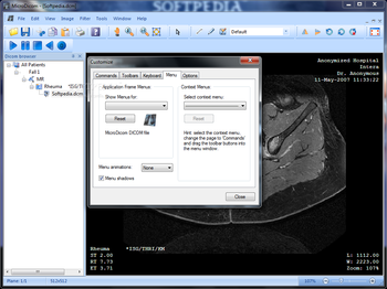 MicroDicom screenshot 9