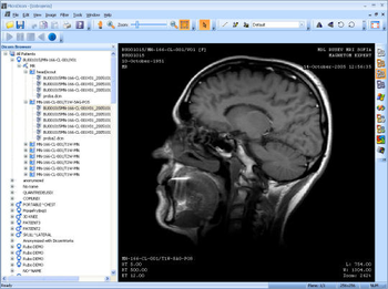 MicroDicom Viewer Autorun screenshot