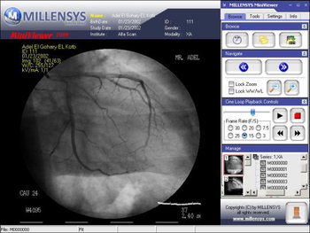 MILLENSYS DICOM Mini Viewer screenshot