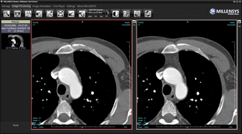 MILLENSYS DICOM Viewer screenshot 2