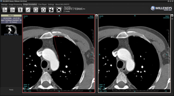 MILLENSYS DICOM Viewer screenshot 3