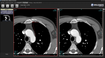 MILLENSYS DICOM Viewer screenshot 4