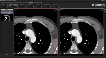 MILLENSYS DICOM Viewer screenshot 5