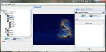 MindSeer screenshot
