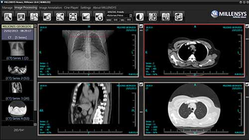 MiViewer screenshot