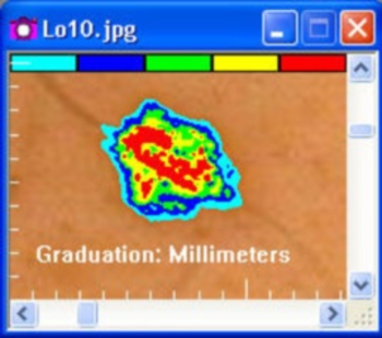 MoleSense screenshot