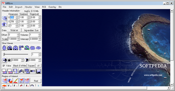 MRIcro screenshot
