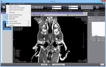 Onis Professional screenshot 6