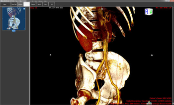 ORPALIS DICOM Viewer Free Edition screenshot