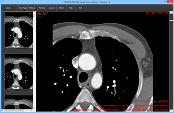 ORPALIS DICOM Viewer screenshot