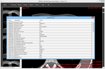 ORPALIS DICOM Viewer screenshot 2