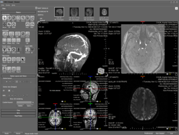 ORS Visual Lite screenshot