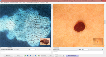 Photo Side-by-Side screenshot 5
