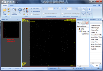 Portable Agnosco DICOM Viewer screenshot