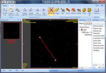 Portable Agnosco DICOM Viewer screenshot 3