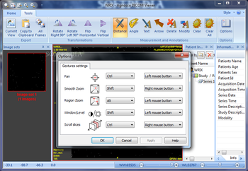 Portable Agnosco DICOM Viewer screenshot 4