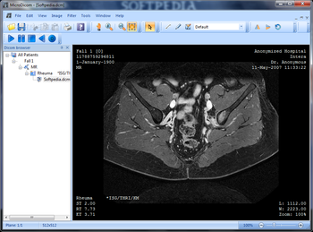 Portable MicroDicom screenshot