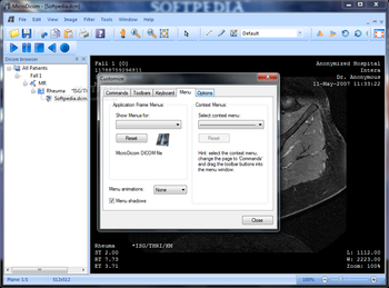 Portable MicroDicom screenshot 10