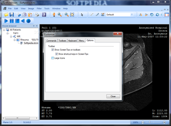 Portable MicroDicom screenshot 11