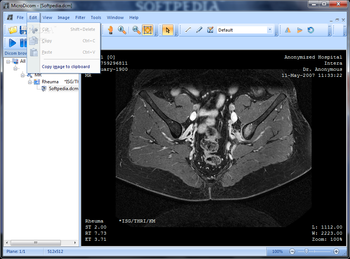 Portable MicroDicom screenshot 2