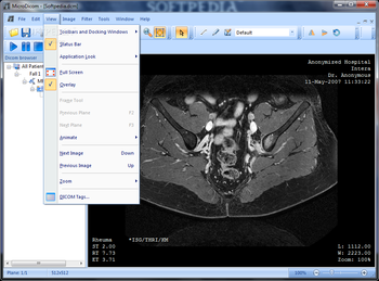 Portable MicroDicom screenshot 3