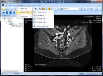 Portable MicroDicom screenshot 4