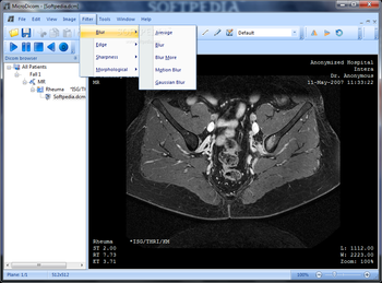 Portable MicroDicom screenshot 5