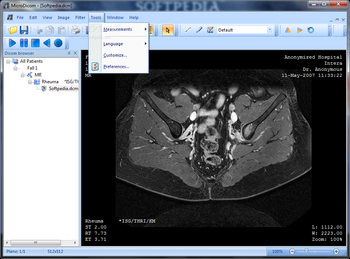 Portable MicroDicom screenshot 6