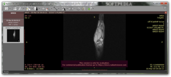 Portable RadiAnt Viewer screenshot