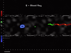 Prognosis screenshot 3