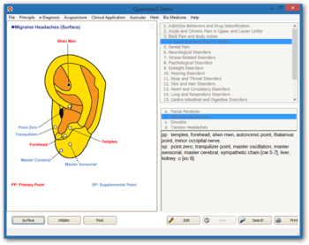 Qpuncture screenshot 4