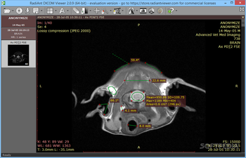 RadiAnt DICOM Viewer screenshot