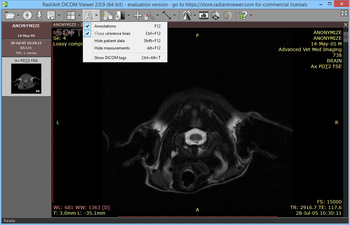 RadiAnt DICOM Viewer screenshot 4