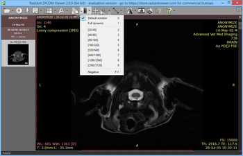 RadiAnt DICOM Viewer screenshot 5