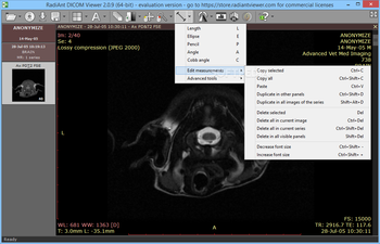 RadiAnt DICOM Viewer screenshot 7