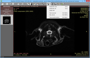 RadiAnt DICOM Viewer screenshot 8