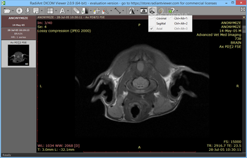 RadiAnt DICOM Viewer screenshot 9