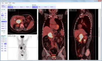 Radis PET-CT screenshot