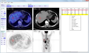 Radis PET-CT screenshot 3
