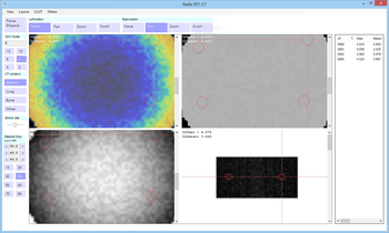 Radis PET-CT screenshot 2