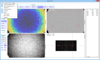 Radis PET-CT screenshot 3