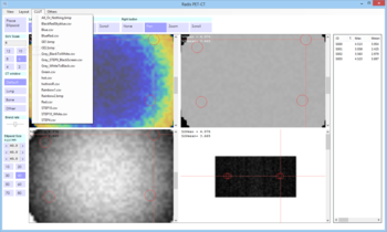 Radis PET-CT screenshot 5