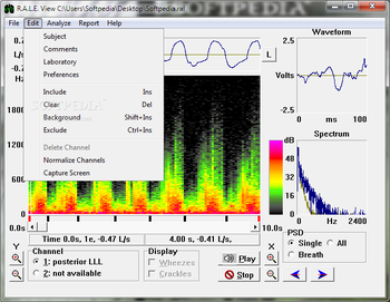 R.A.L.E. View screenshot 2