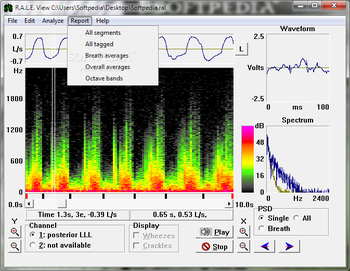 R.A.L.E. View screenshot 3