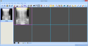 Sante CT Viewer screenshot