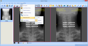 Sante CT Viewer screenshot 10